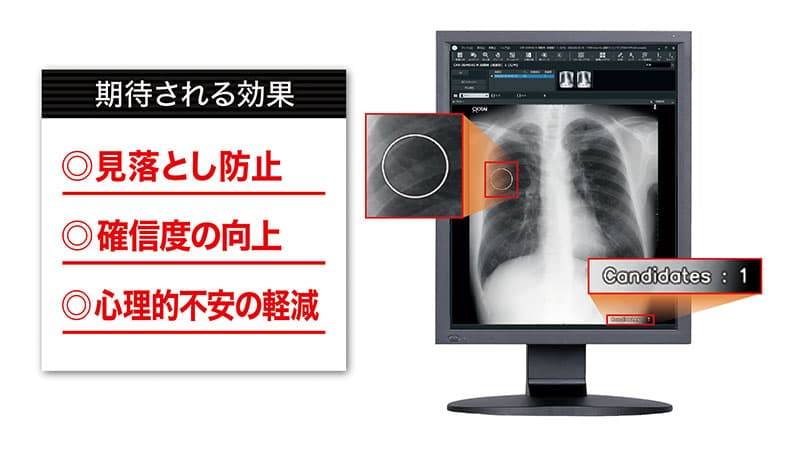 cxr画像