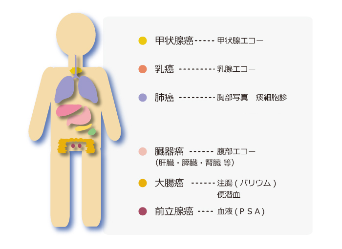 画像：当院でできるがん検査
